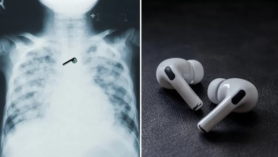 Se quedó dormido, se tragó uno de sus auriculares ¡y sigue funcionando!