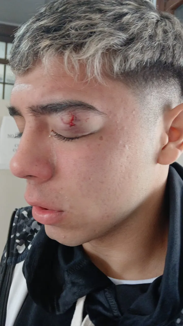 ATE repudió la violenta represión en Córdoba ATE repudió la violenta represión en Córdoba
