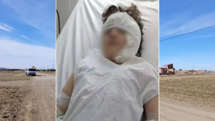 Nena atacada por pitbull