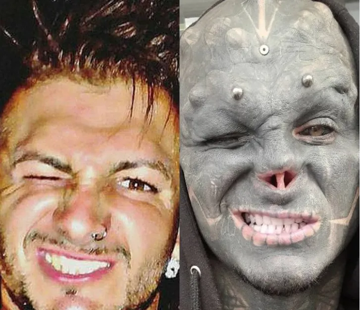 Increíble transformación quirúrgica de un fanático para convertirse en alien