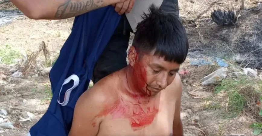 El enfrentamiento produjo cinco muertos y varios heridos
