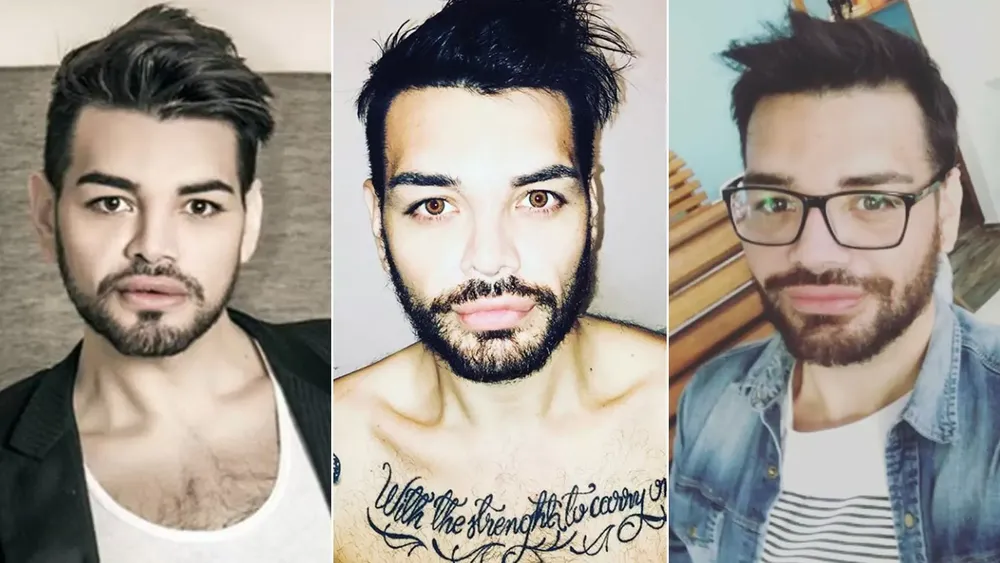 ¡Impresionante! Así quedó después de 28 operaciones para emular a Ricky Martin