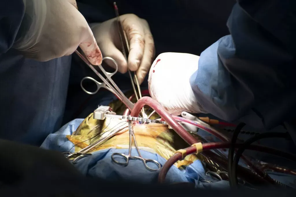 Por iniciativa argentina, la ONU fijo al 16 de septiembre como "Dia Mundial de la Cardiologia Intervencionista"